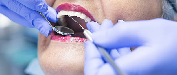 Best Emergency Tooth Extraction in Midway South, TX